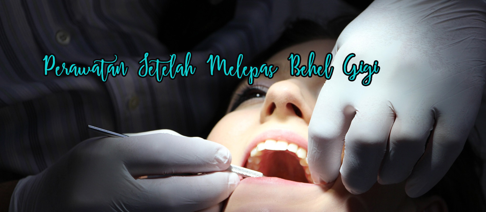 Perawatan Gigi Setelah Lepas Behel